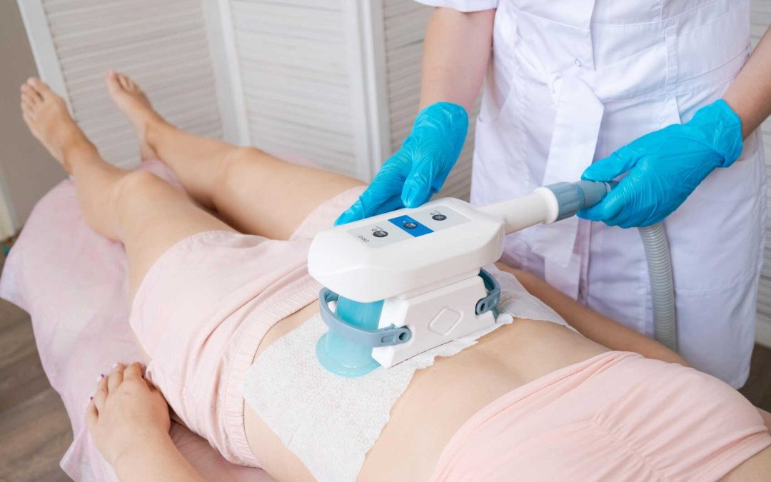 Best Areas to Treat with CoolSculpting in Corpus Christi & Portland: Abdomen, Flanks, Arms, and More